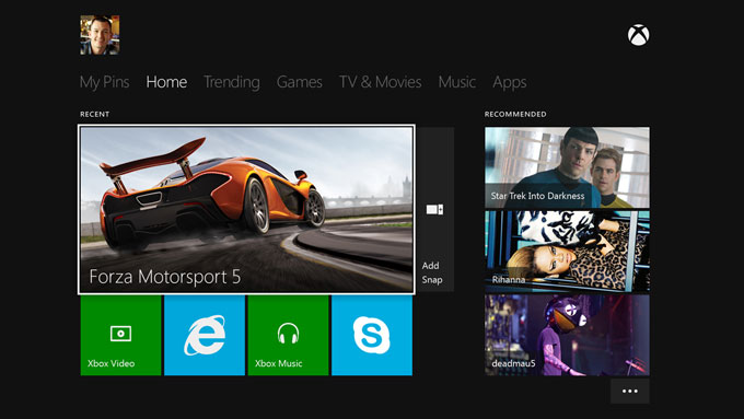 Xbox